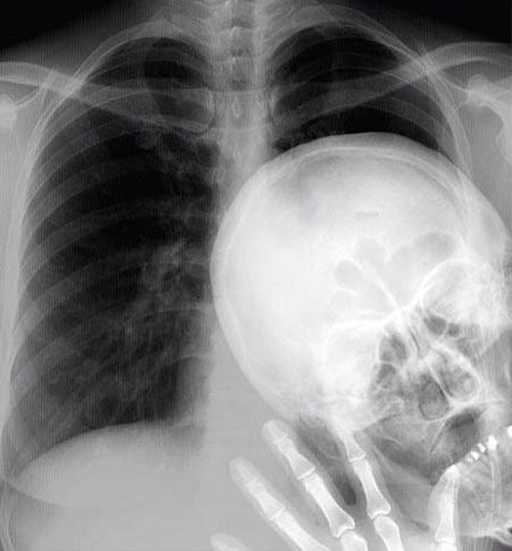 二十张充满惊喜的X光照片 世界上第一张x光片是什么样的